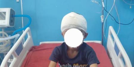 معجزة طبية في سوهاج.. استخراج رصاصة من مخ طفل وإنقاذه دون مضاعفات