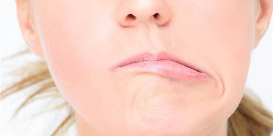 تدلي
      الجفون،
      مؤشر
      للإصابة
      بمتلازمة
      هورنر
      وهذه
      أسبابها