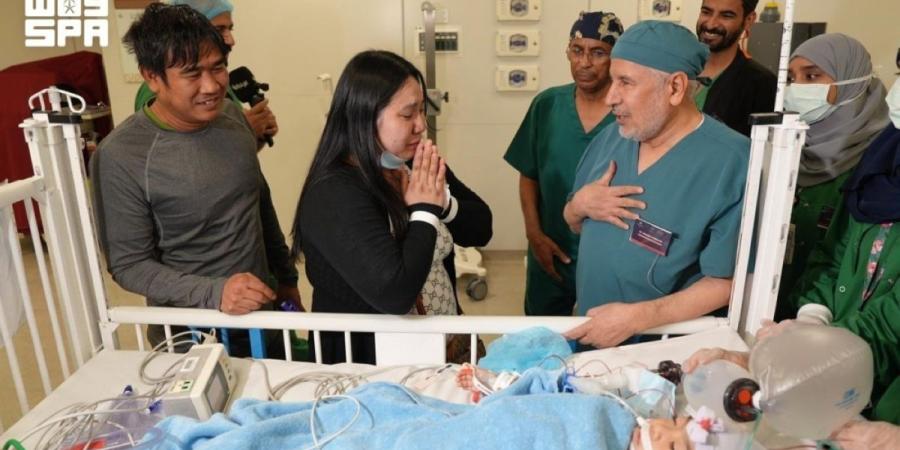 نجاح عملية فصل التوأم
الملتصق الفلبيني (أوليفيا وجيانا) بعد 6 ساعات - ترند نيوز