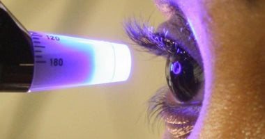 الجلوكوما خطر يهدد صحة البصر فى صمت.. كيف تحمى نفسك؟