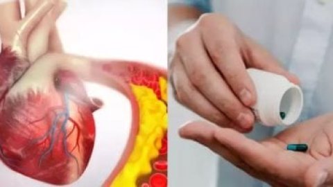 الكوليسترول مش مجرد رقم.. لماذا يختلف هدف LDL من شخص لآخر؟