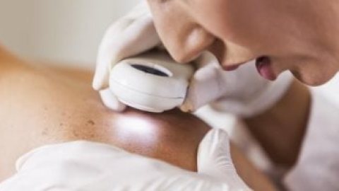 لقاح سرطان الجلد الشخصي.. تجربة جديدة تمنح مريض ميلانوما الأمل